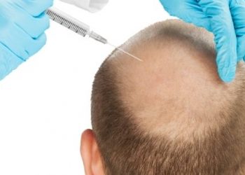 Hair Transplant
