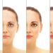 The Installation of Fall Detection Devices Can Improve the Health of An Aging Population
