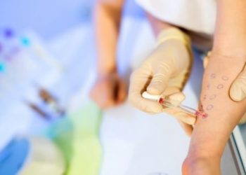 skin prick tests in London