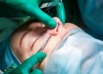 Rhinoplasty Nose Reshaping in Islamabad