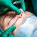 Rhinoplasty Nose Reshaping in Islamabad